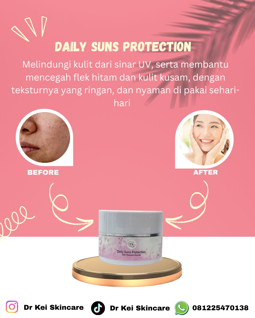 Dr Kei Beauty Care Daily Suns Protection With Titanium Dioxide 10 Gr
