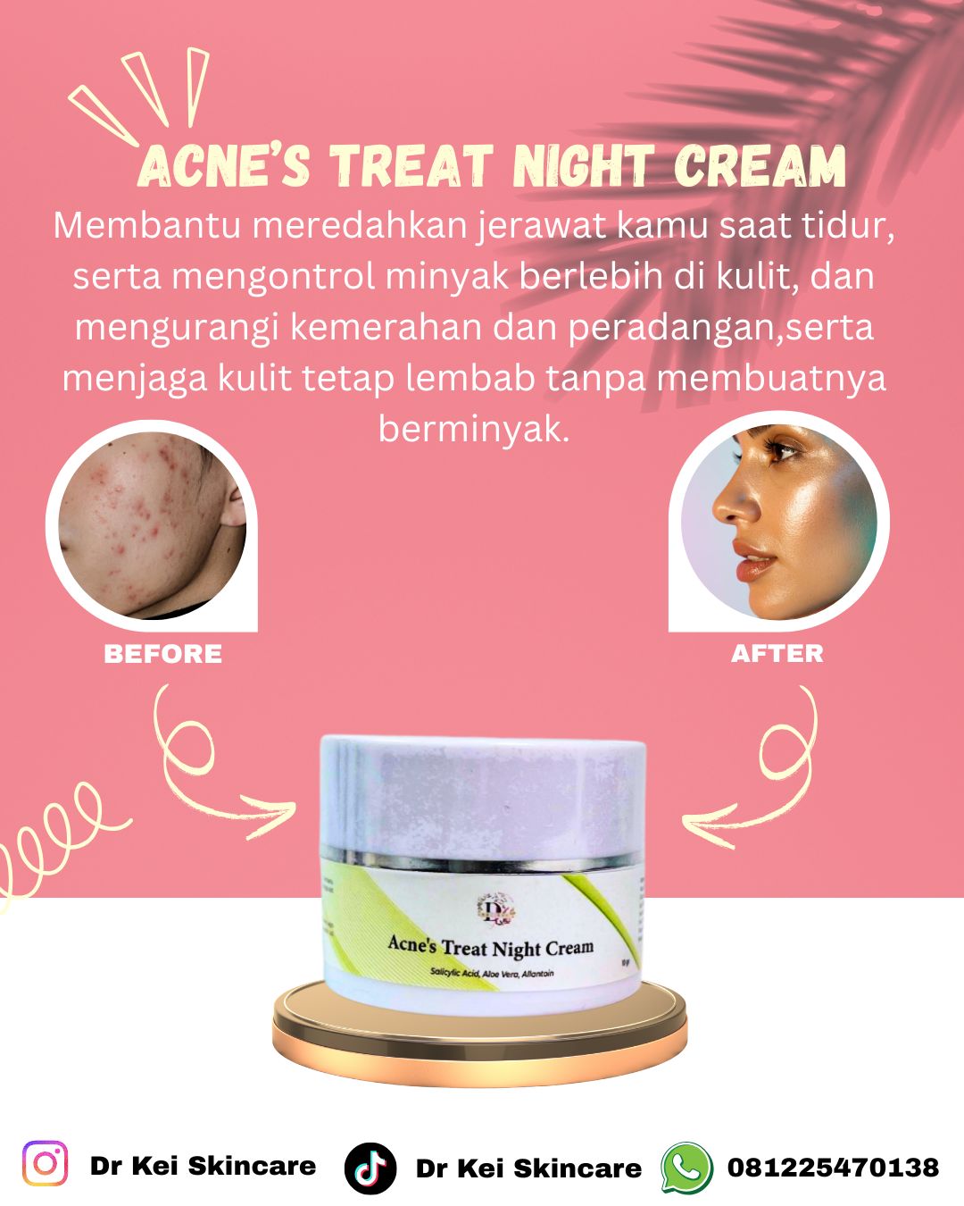 Dr Kei Beauty Care Acnes Treat Night Cream 10 Gr