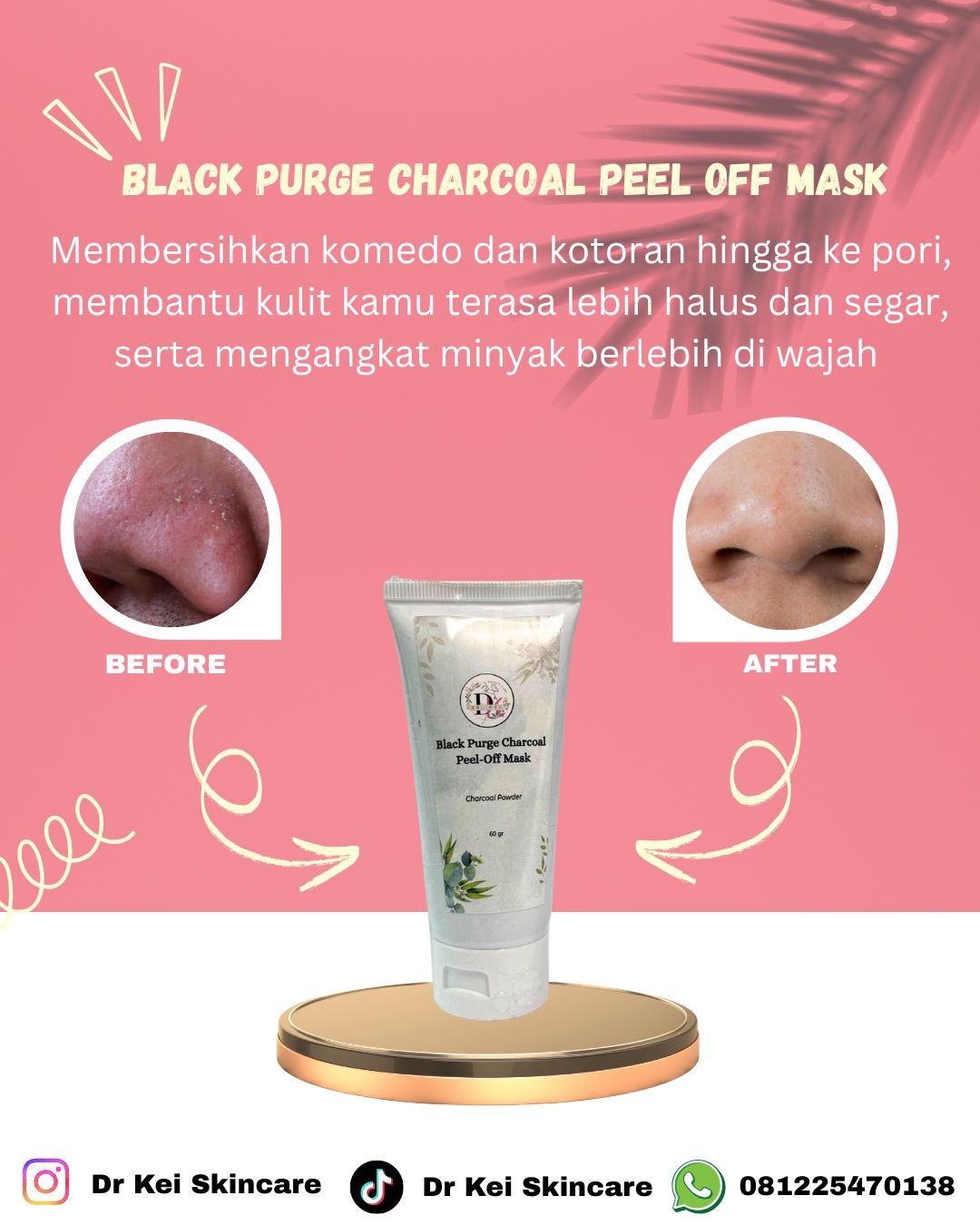 Dr Kei Beauty Care Black Purge Charcoal Peel Off Mask 60 Gr