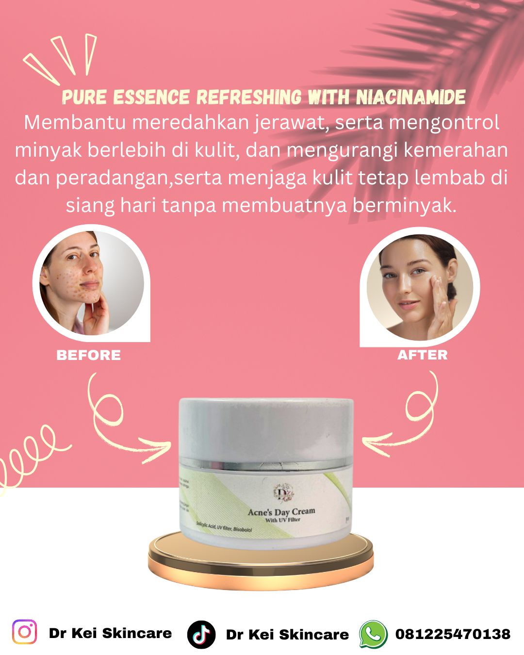 Dr Kei Beauty Care Acnes Day Cream With UV Filter 10 Gr